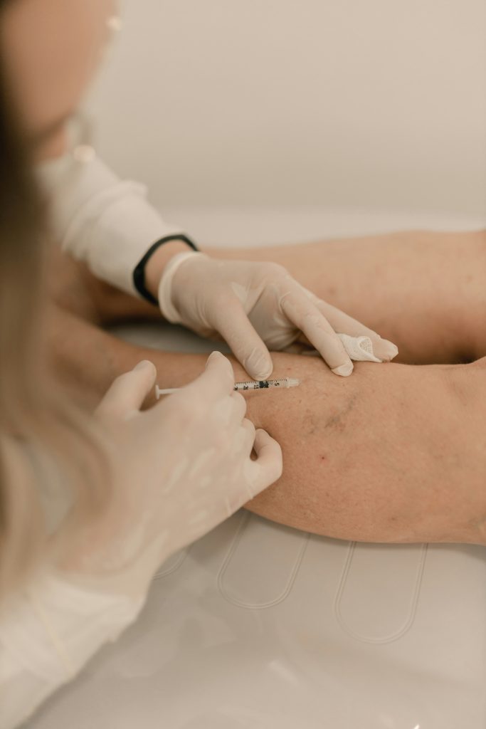 Médico estético aplicando esclerosis con microinyecciones en las arañas vasculares de la pierna de una paciente en una consulta de medicina estética en Valladolid